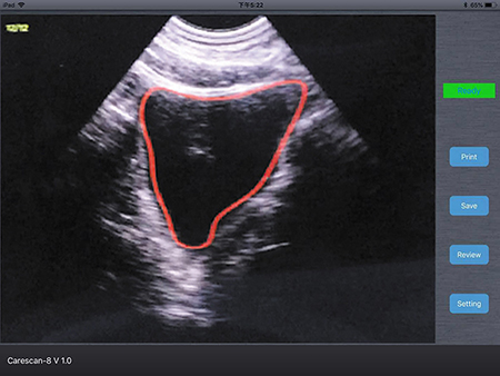 Bladder Ultrasound