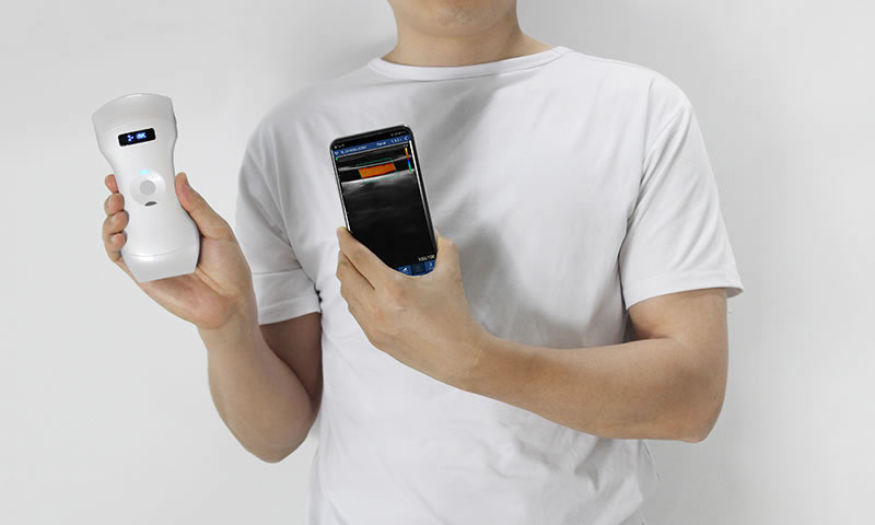 Wireless Handheld Pocket Ultrasound vs. Traditional Cart-Based Ultrasound: What Are the Differences